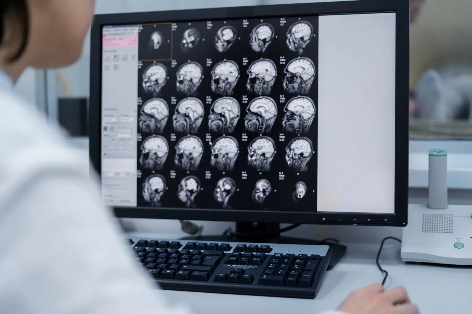 Neurociencia Aplicada al Trauma y la Plasticidad Cerebral